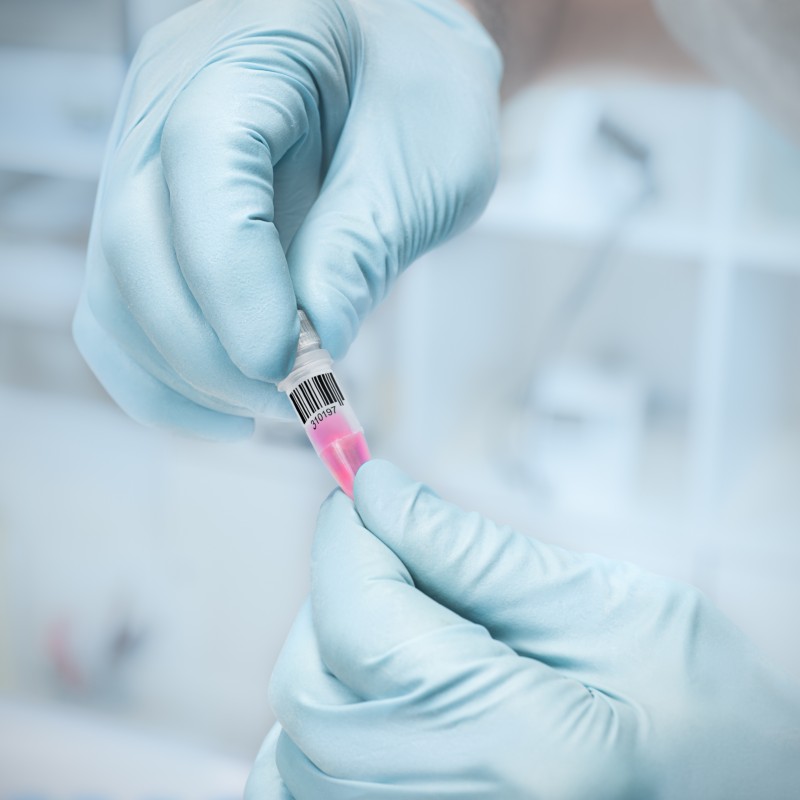 Fluorescent Antibody Labeling: Dye Selection, Degree of Labeling, and Signal Optimization